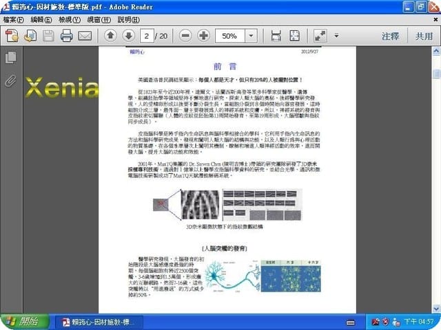 【補充】 Xenia的幼腦檢測報告 - 第2張圖 【補充】 Xenia的幼腦檢測報告