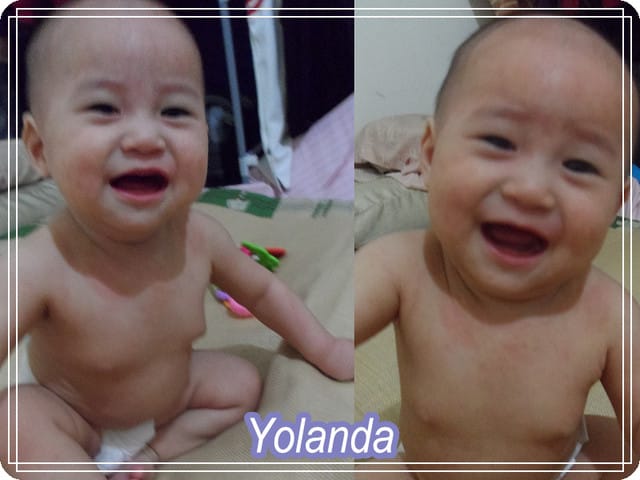 【Yolanda成長點滴】6M22D確定病毒疹
