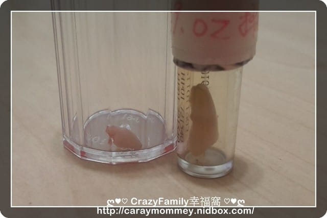 Xenia的乳牙記錄：右下門牙乳牙掉落