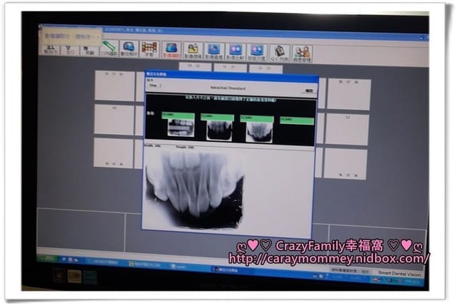 Yolanda牙科首次X光檢查