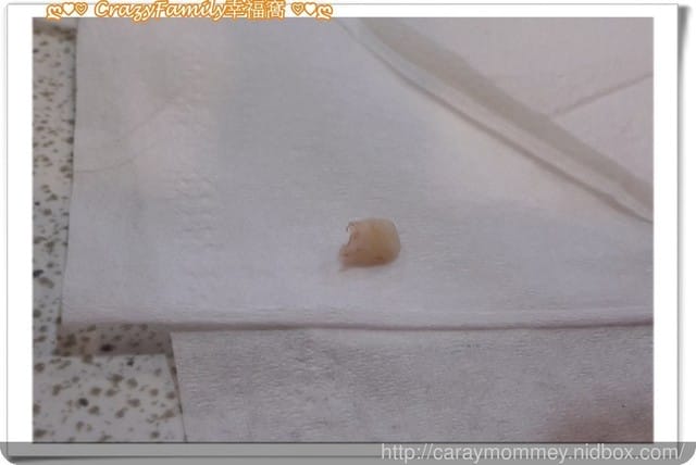 Xenia的乳牙記錄:左下, 側門牙 - 第4張圖 Xenia的乳牙記錄:左下, 側門牙