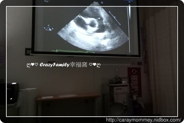 Yolanda 小兒心臟超音波檢查