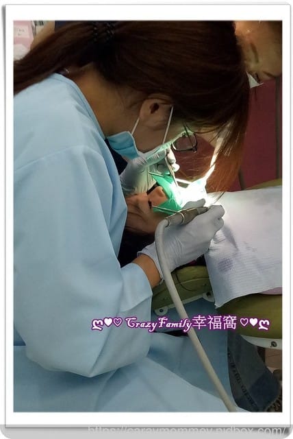 【 Yolanda 】 5y11m治療牙縫蛀牙2