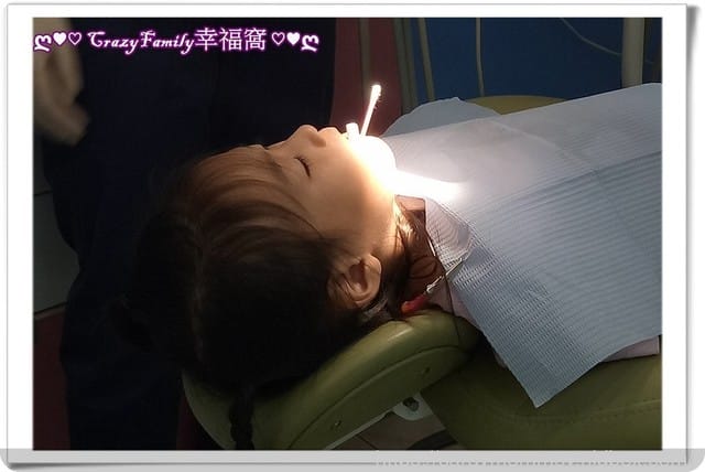 【 Yolanda 】 5y11m治療牙縫蛀牙2
