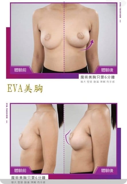 ✿ღ 愛美分享 ✿ღ EVA美胸沙龍 - 第10張圖 ✿ღ 愛美分享 ✿ღ EVA美胸沙龍
