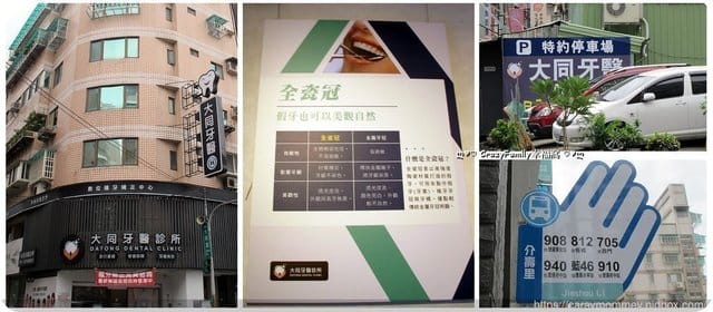 分享優質牙醫診所∮擁有全瓷冠美齒假牙一日即能獲得