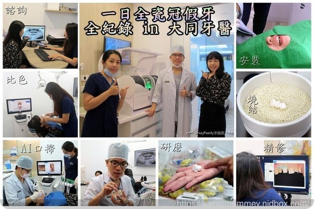 分享優質牙醫診所∮擁有全瓷冠美齒假牙一日即能獲得