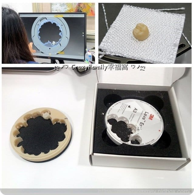 分享優質牙醫診所∮擁有全瓷冠美齒假牙一日即能獲得