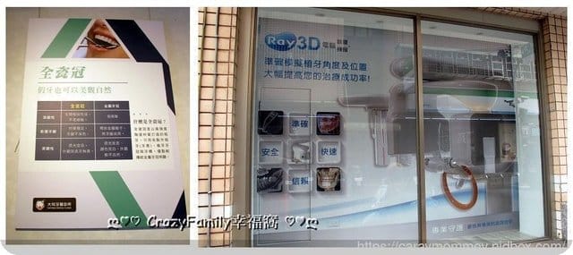 分享優質牙醫診所∮擁有全瓷冠美齒假牙一日即能獲得