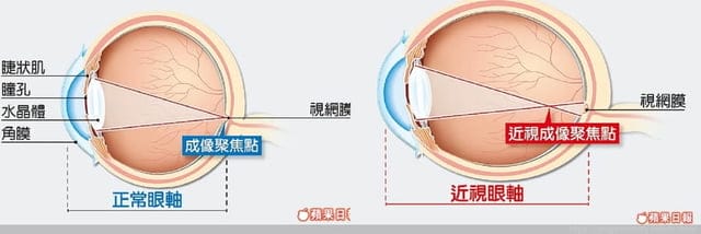 開箱 ❡ 多點蜂巢微透鏡片 - 第2張圖 開箱 ❡ 多點蜂巢微透鏡片